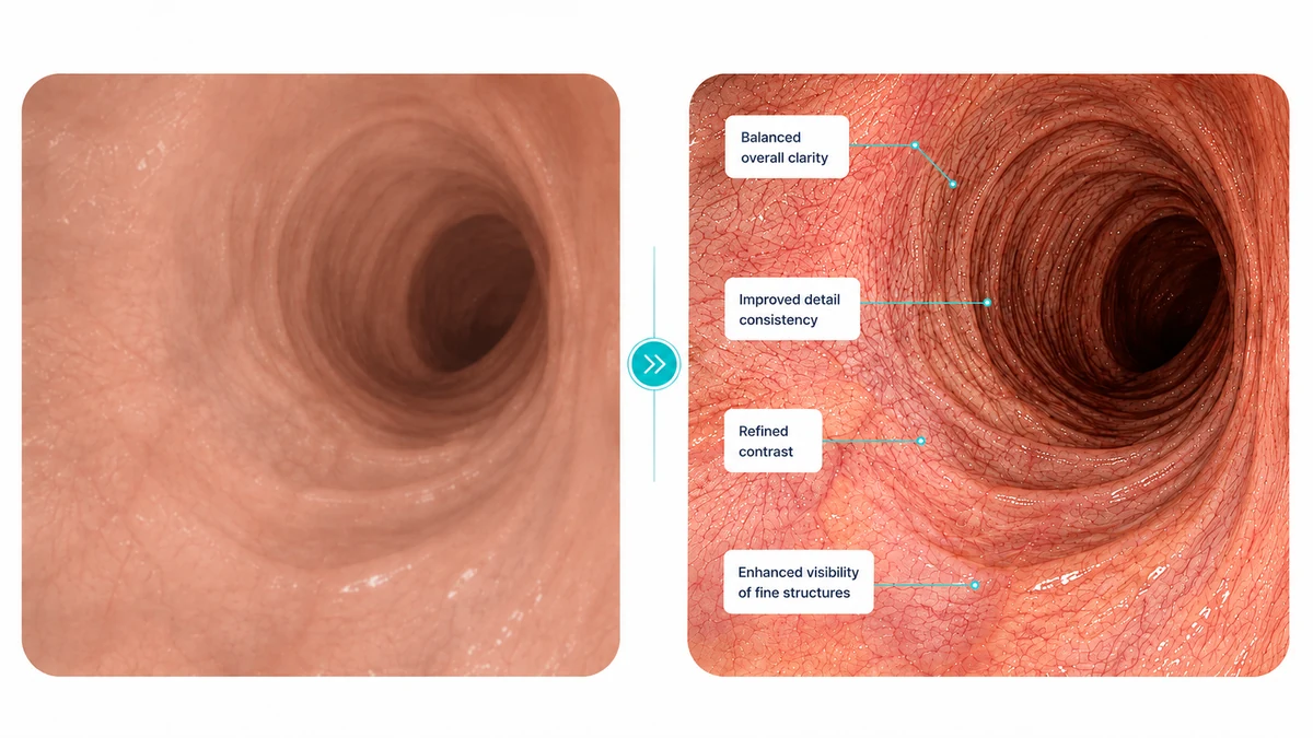 AI surgical image enhancement comparison showing improved clarity and contrast