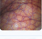Endoscopy image illustrating variable color and contrast