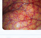 Endoscopy image illustrating more consistent color and contrast