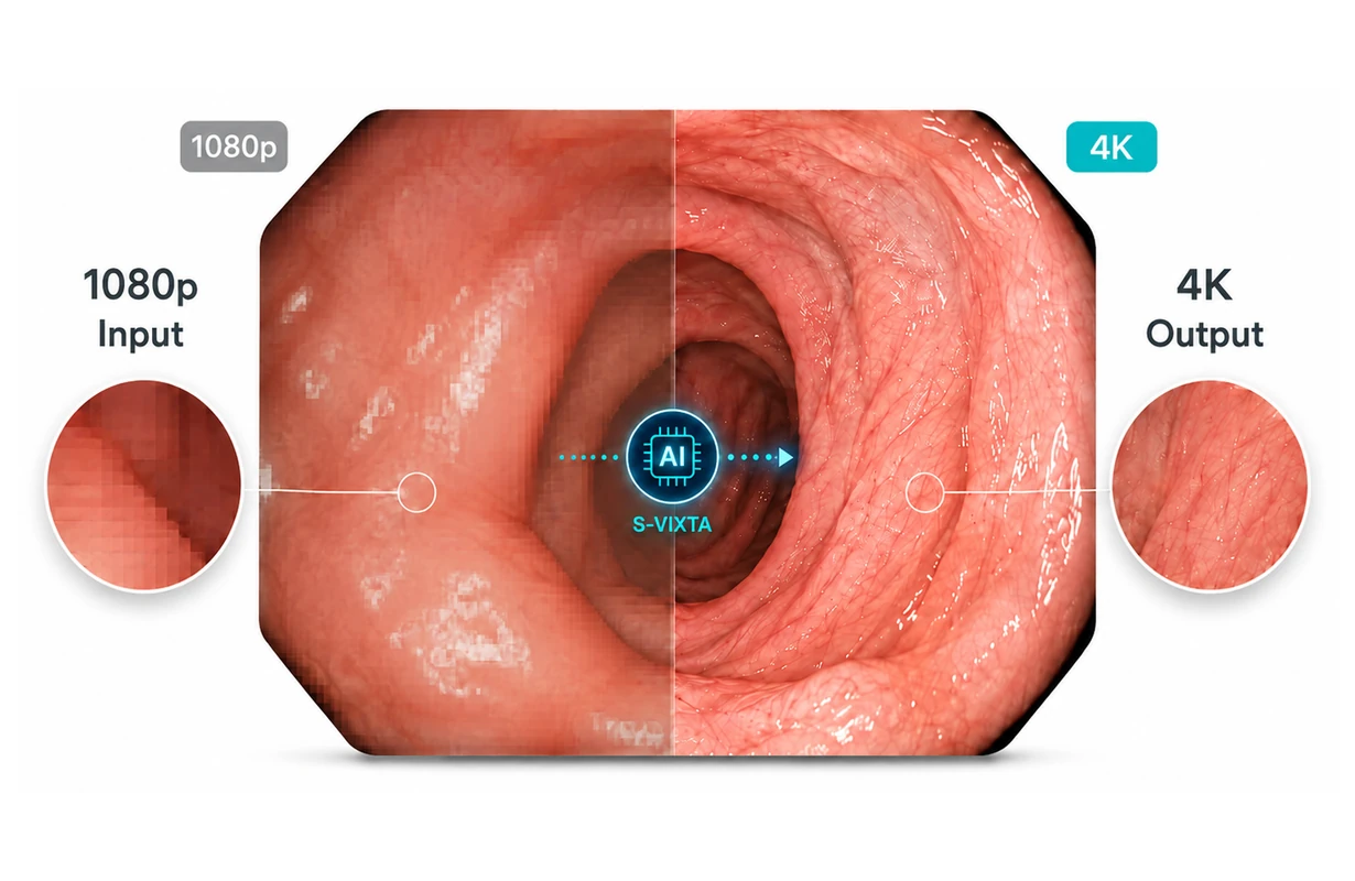 1080p input enhancement for 4K medical visualization with S-VIXTA