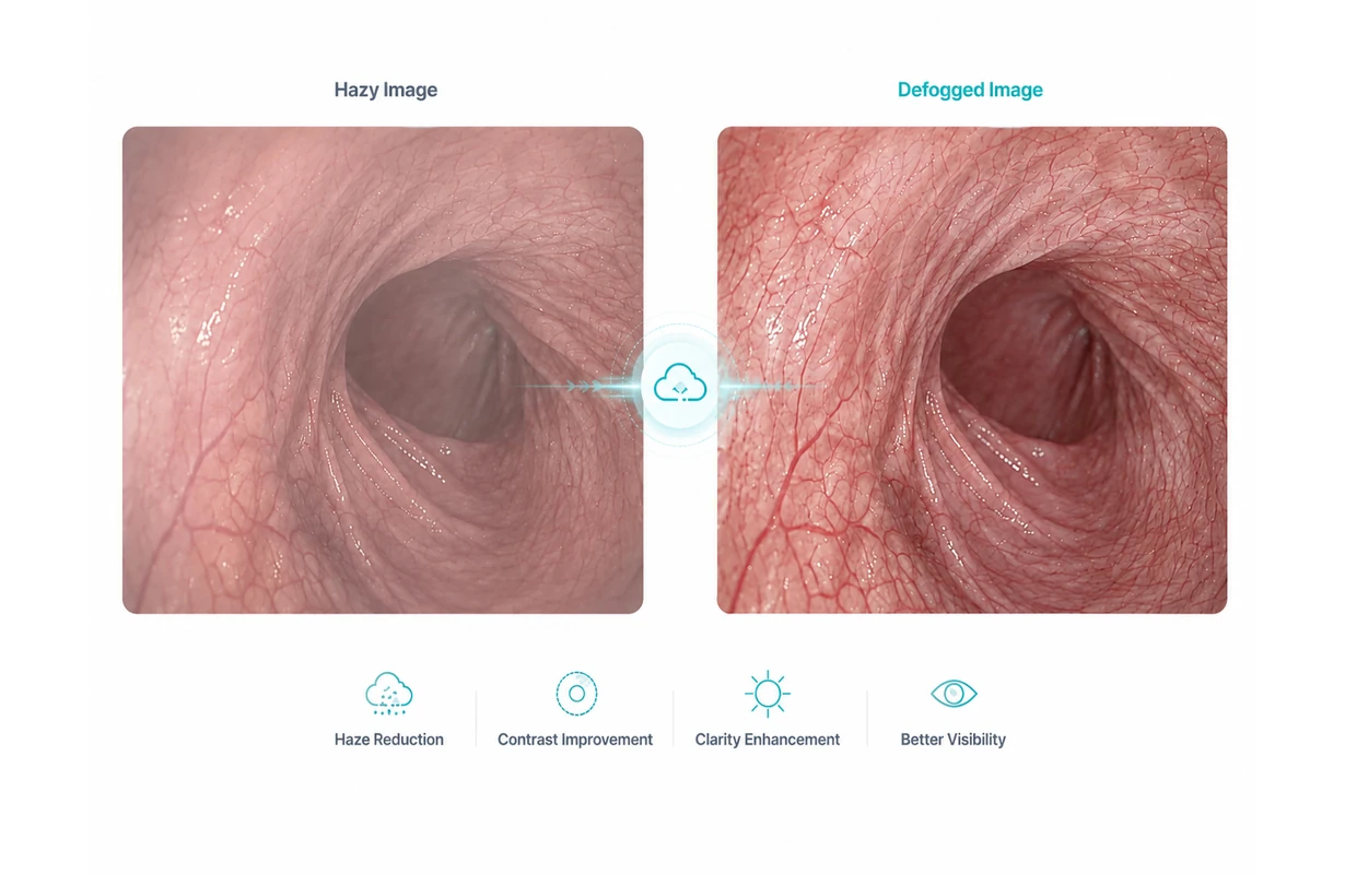 S-VIXTA Defog comparison for hazy medical images