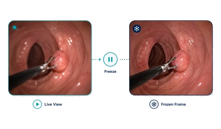 Live view and frozen-frame comparison
