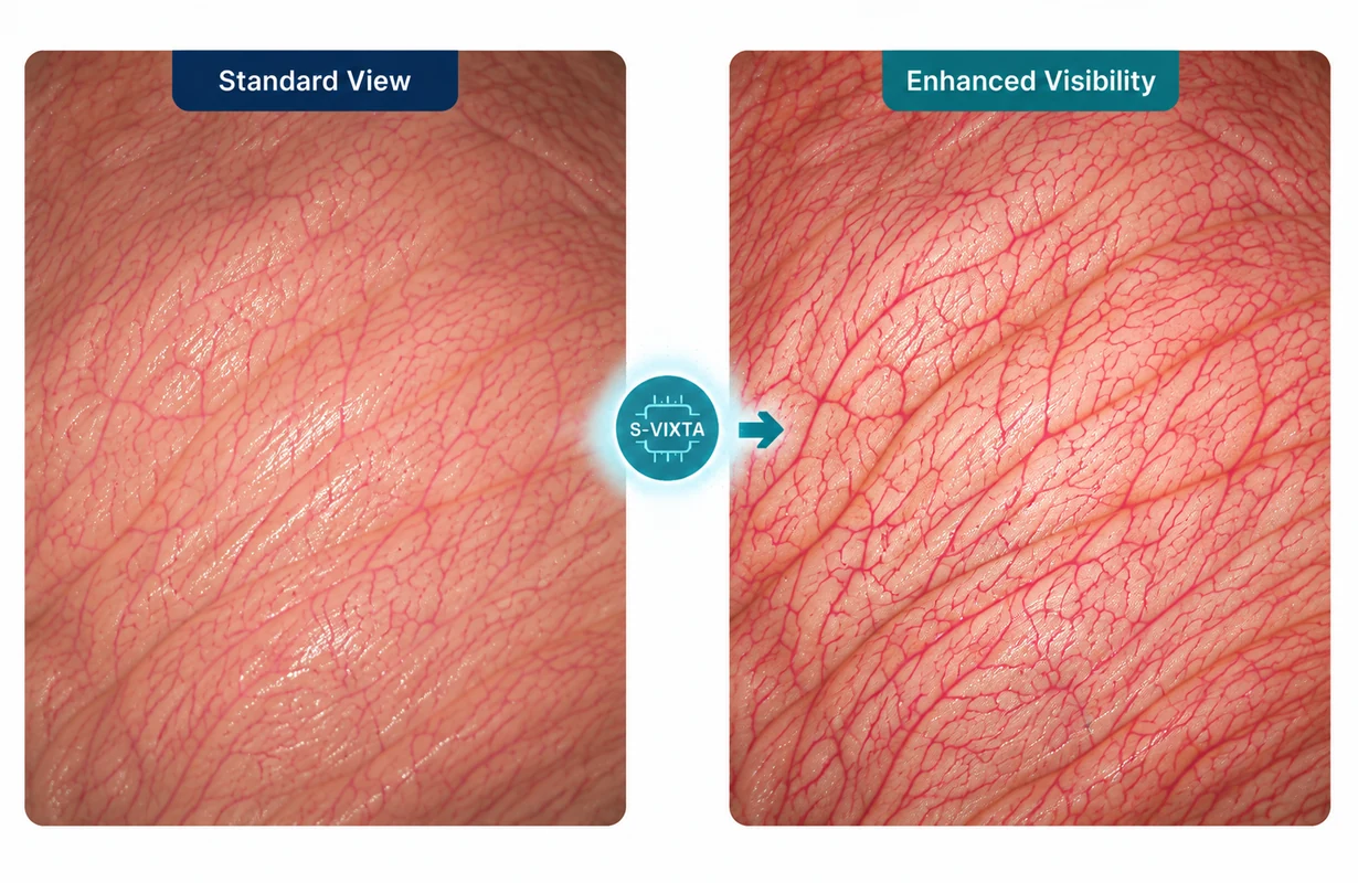 Vessel and tissue visibility enhancement comparison