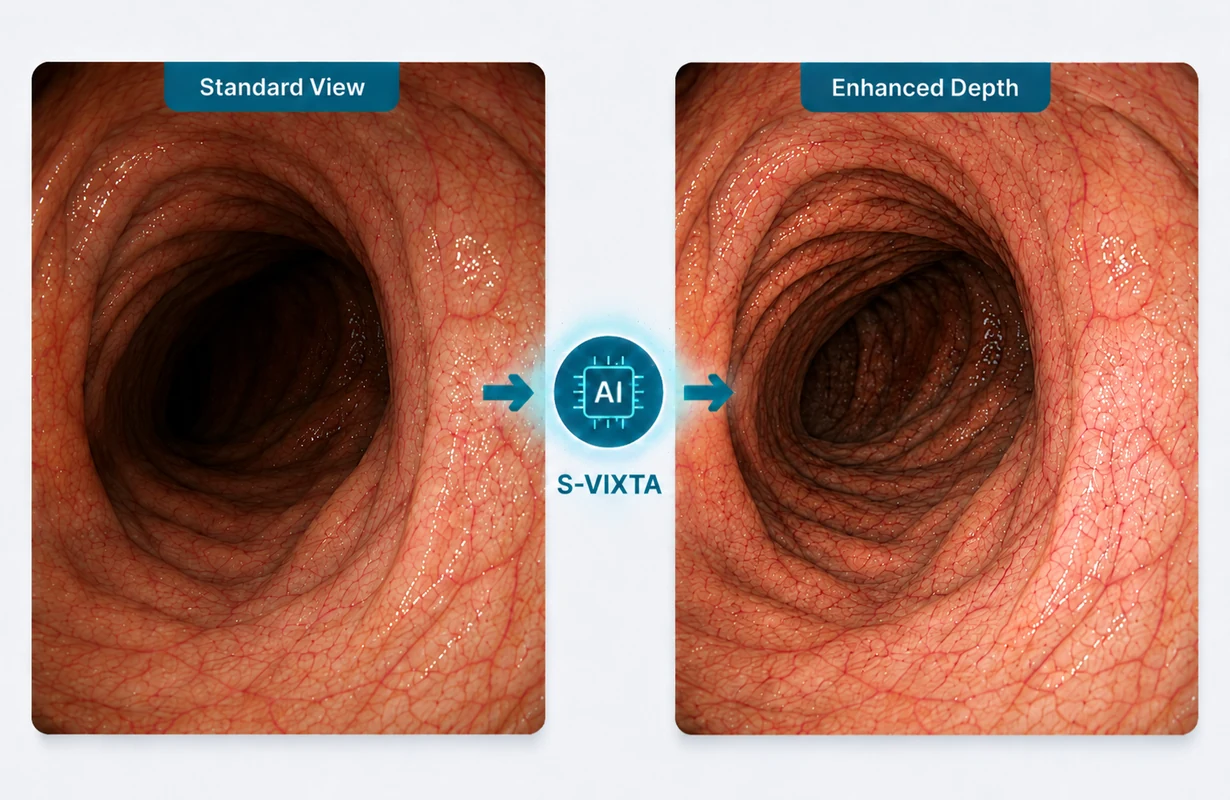 Core visualization comparing standard image presentation with S-VIXTA Depth Enhancement