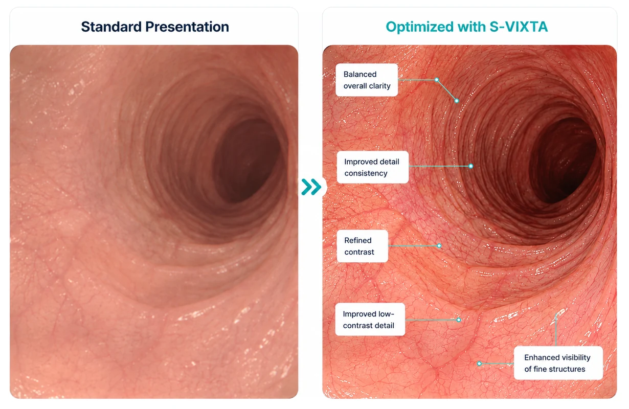 Core visualization comparing standard presentation with global image optimization by S-VIXTA
