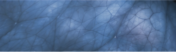 Minimal enhancement image presentation