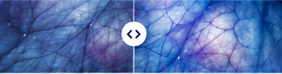 Maximum enhancement image presentation