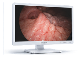Professional medical display showing endoscopic imagery