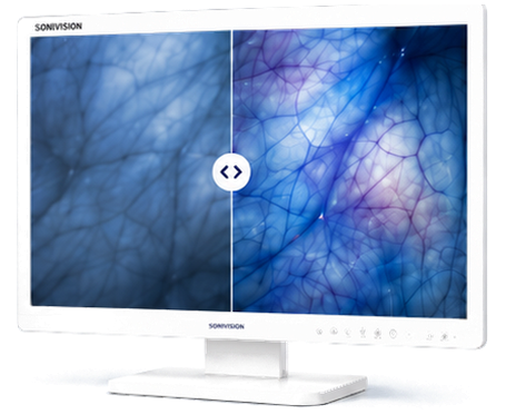 Medical display showing optimized image presentation