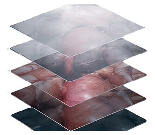 Layered image factors including haze, contrast, vessel visibility, tissue detail and depth
